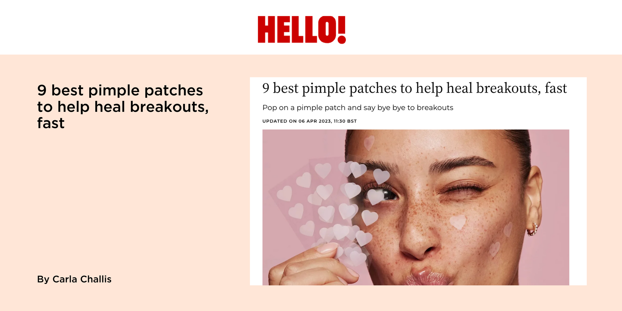 9 best pimple patches to help heal breakouts, fast