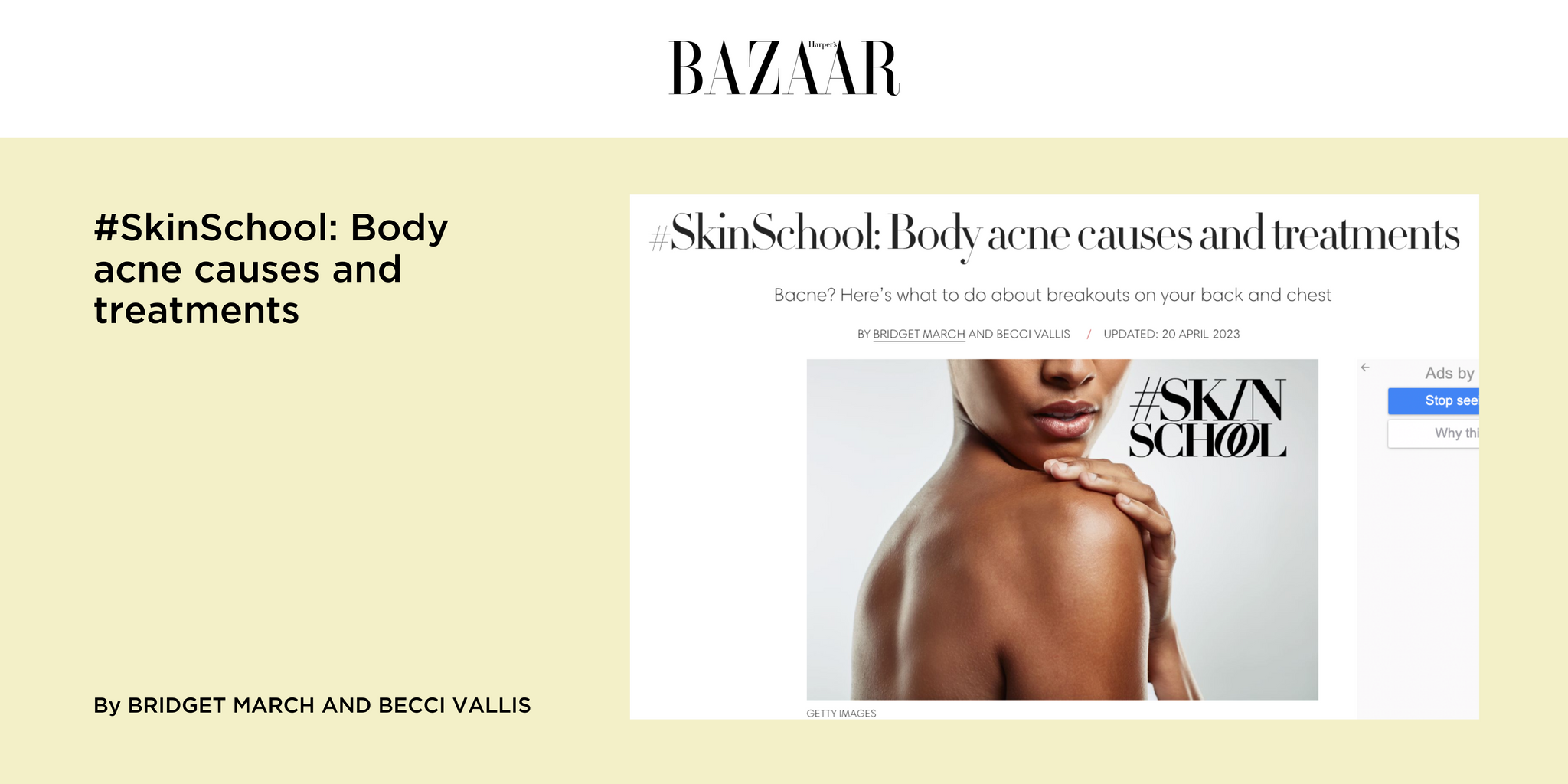 #SkinSchool: Body acne causes and treatments