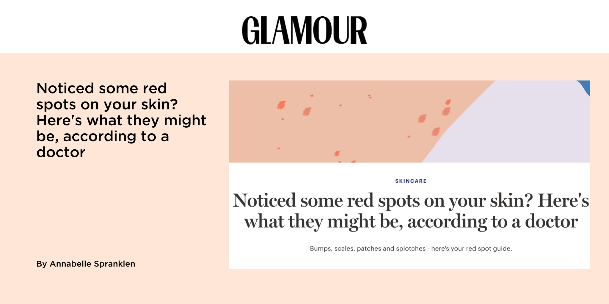 Noticed some red spots on your skin? Here's what they might be, according to a doctor