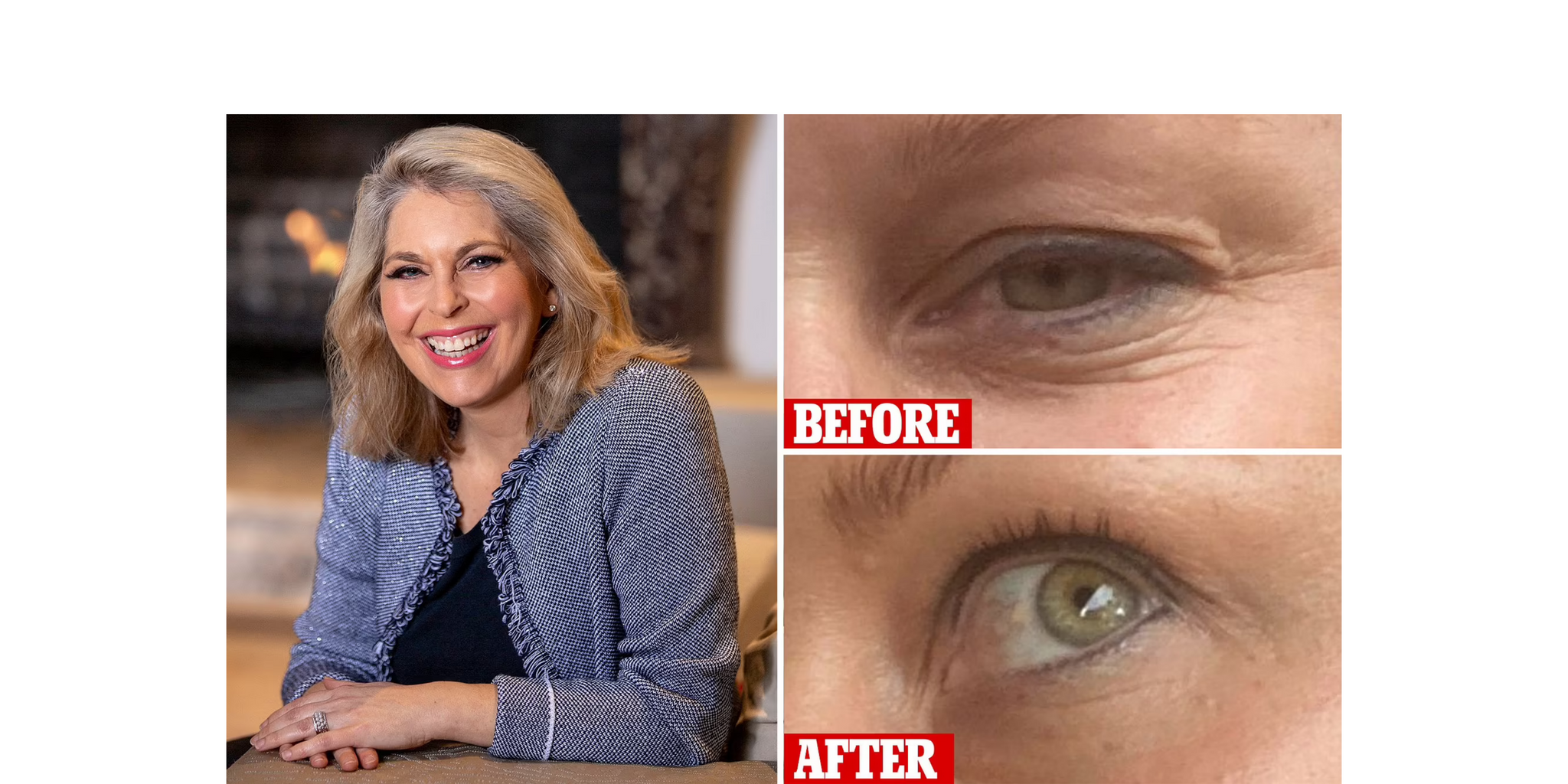 Ageless Before & Afters - Daily Mail