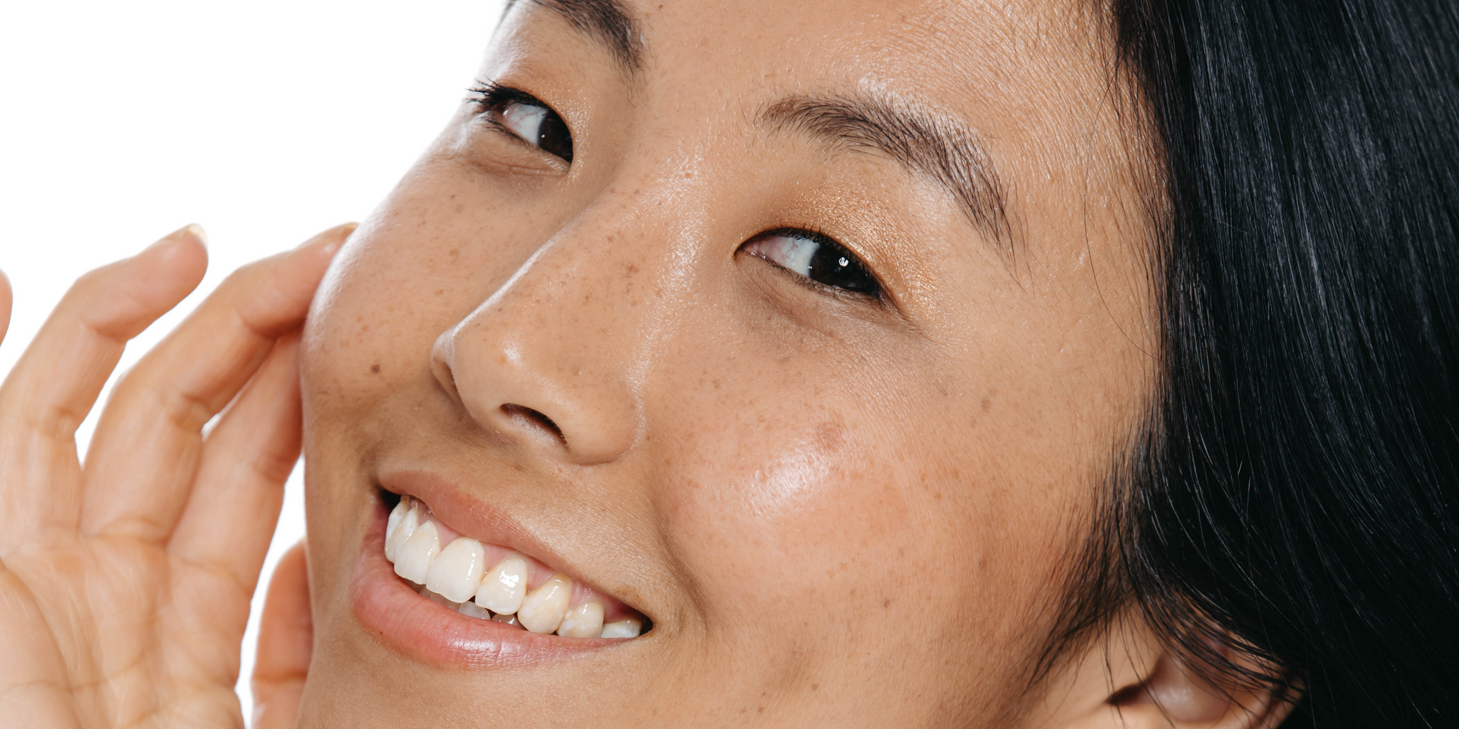 Melasma in pregnancy- is it safe to treat it?