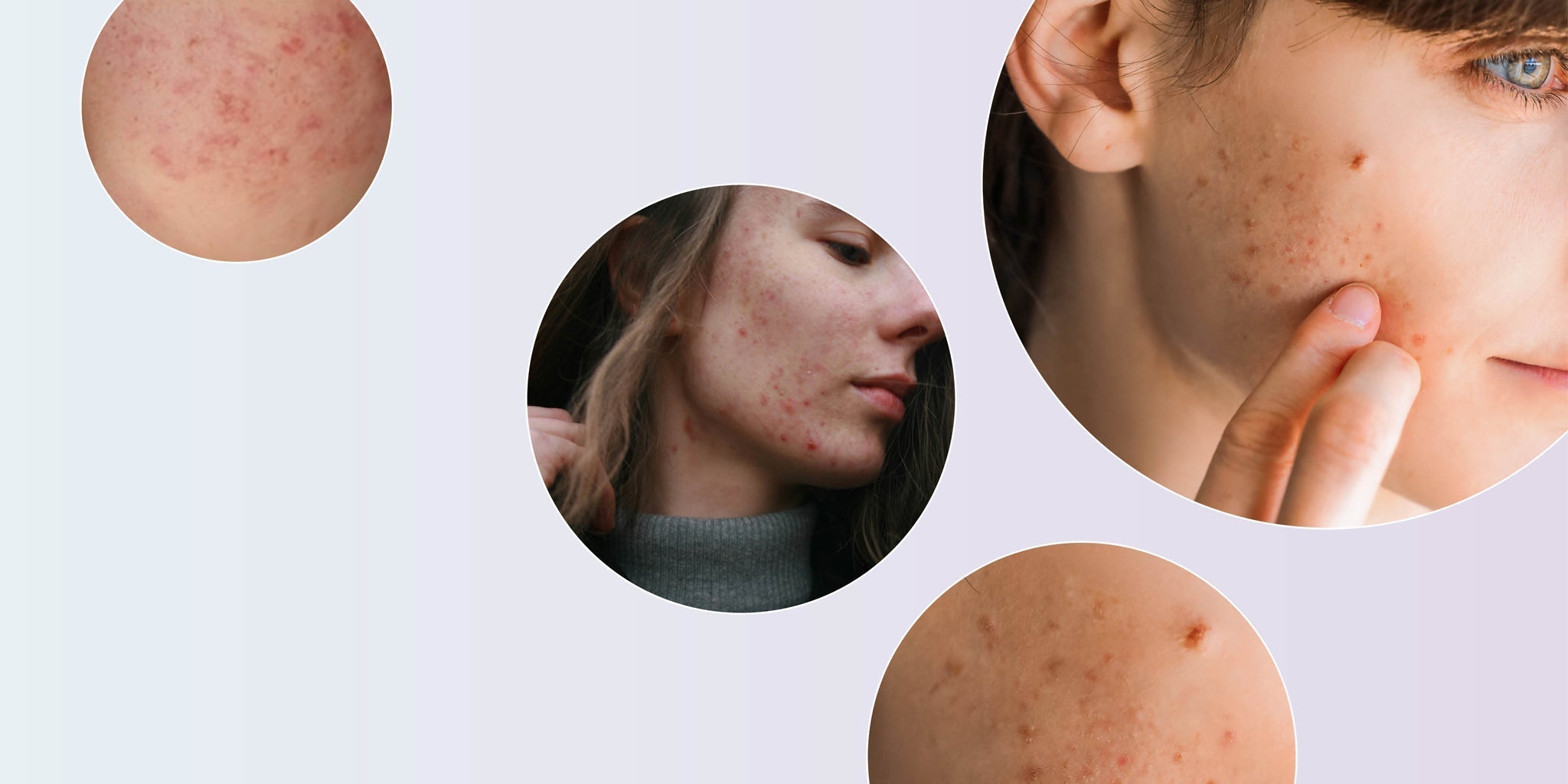 What Your Skin Is Telling You: The Most Common Complaints and When to Worry