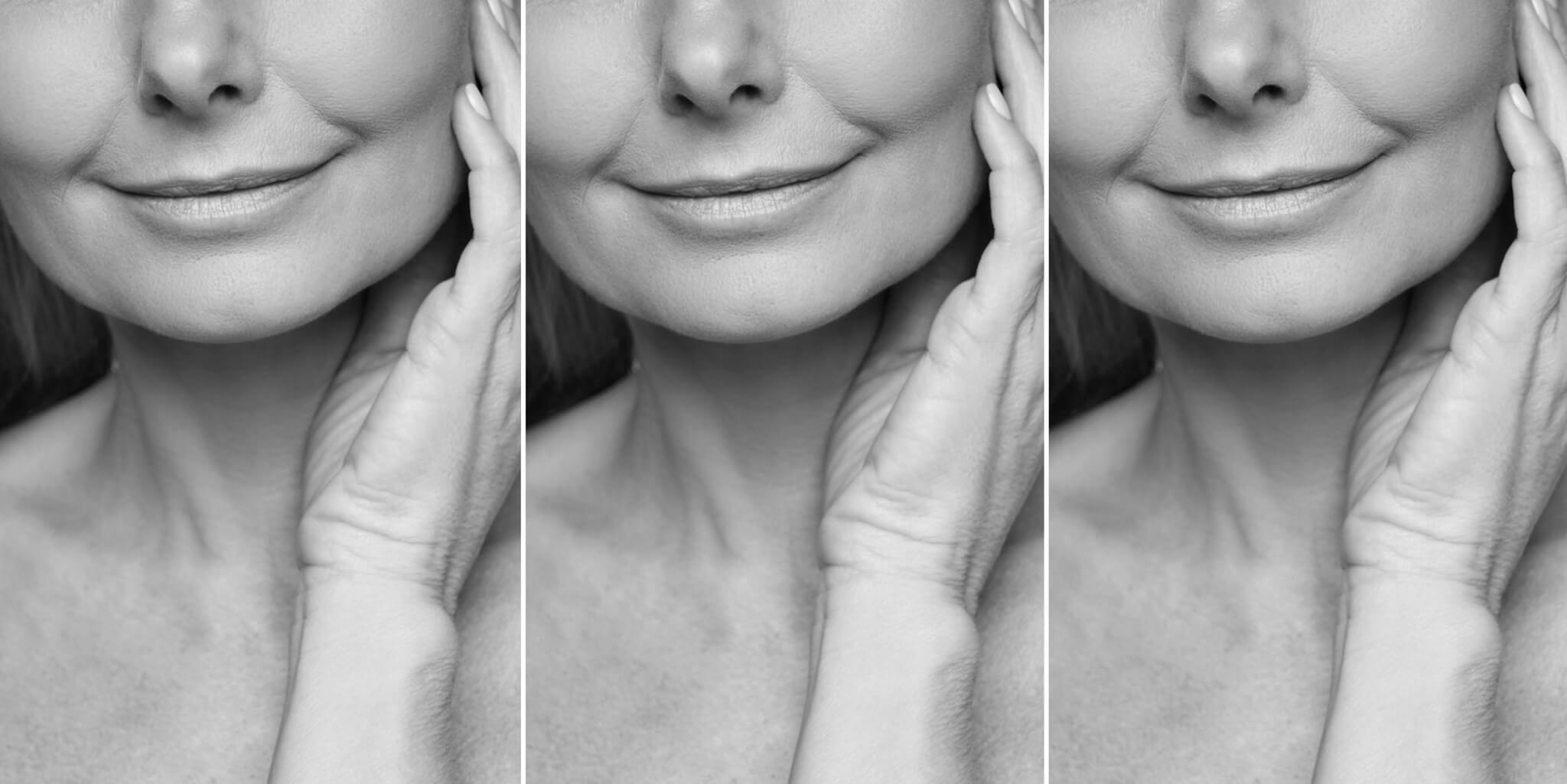 Your neck is aging faster than your face, and no, a cream isn't going to fix it