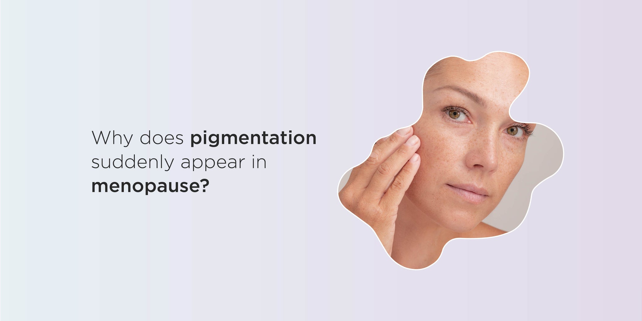Why does pigmentation suddenly appear in menopause?
