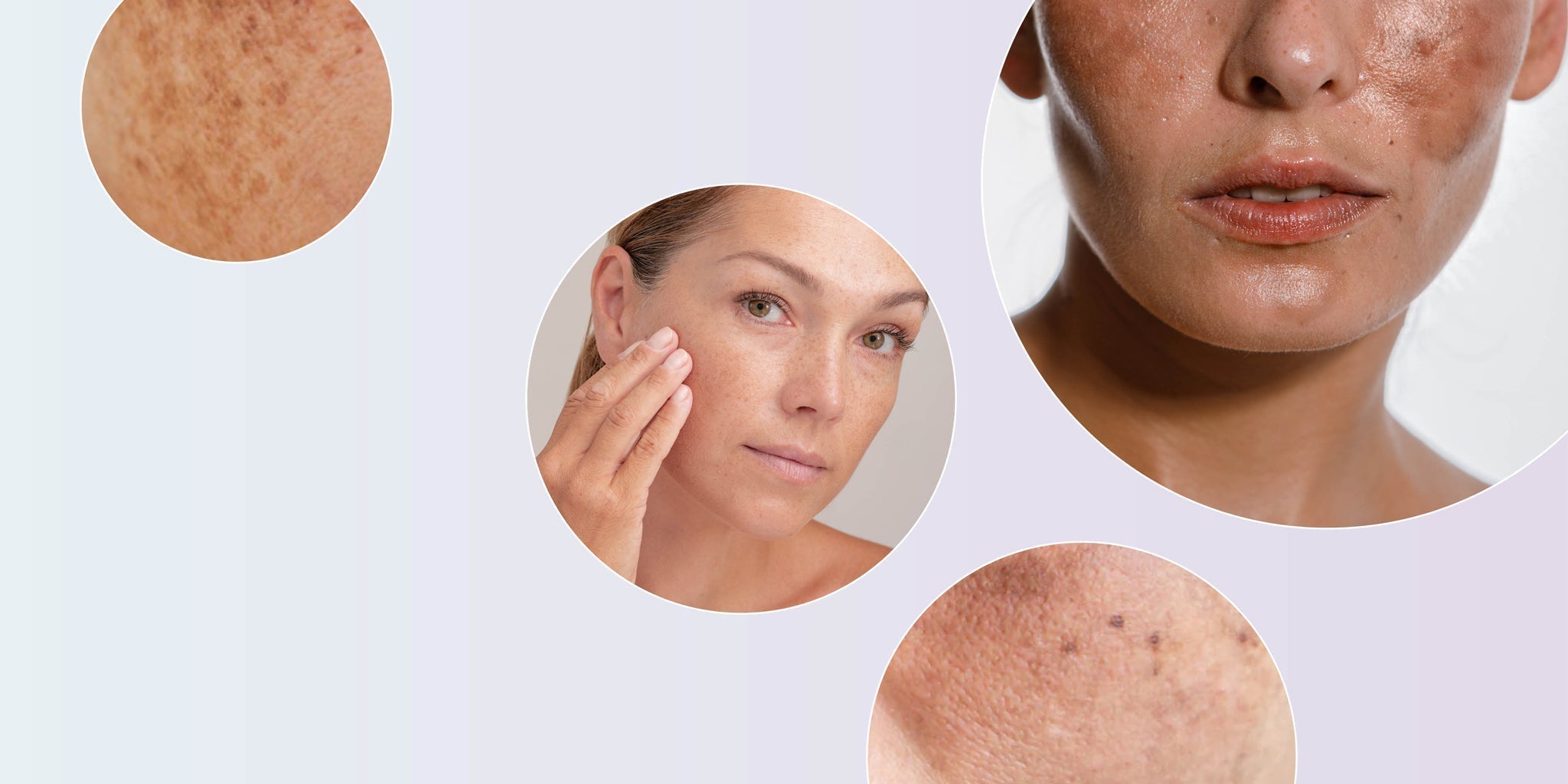 Pigmentation 101