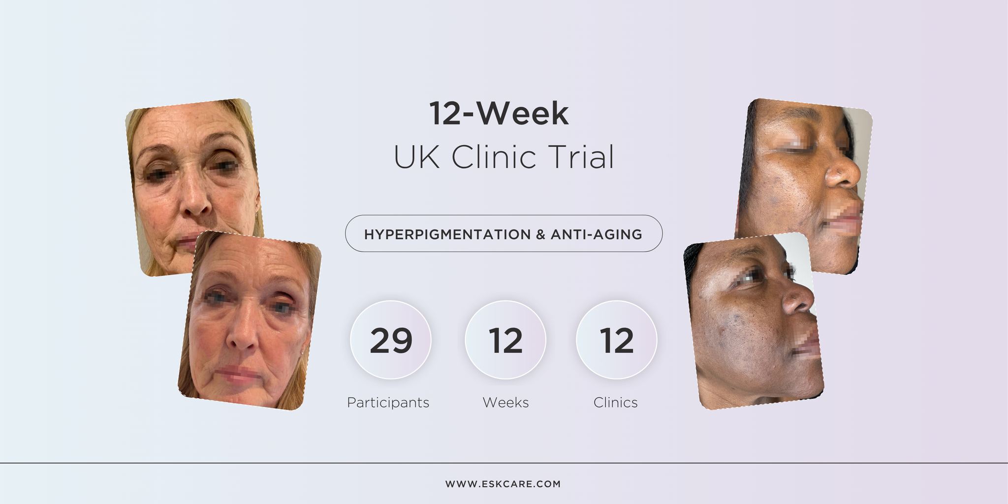 The Results Are In: Our 12-Week UK Clinical Trial on Hyperpigmentation; Skin Aging