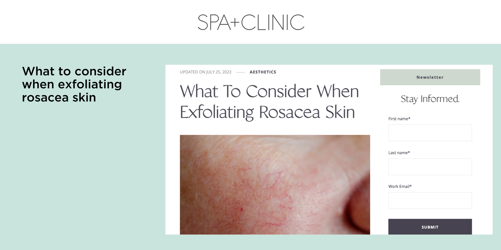 What to consider when exfoliating rosacea skin