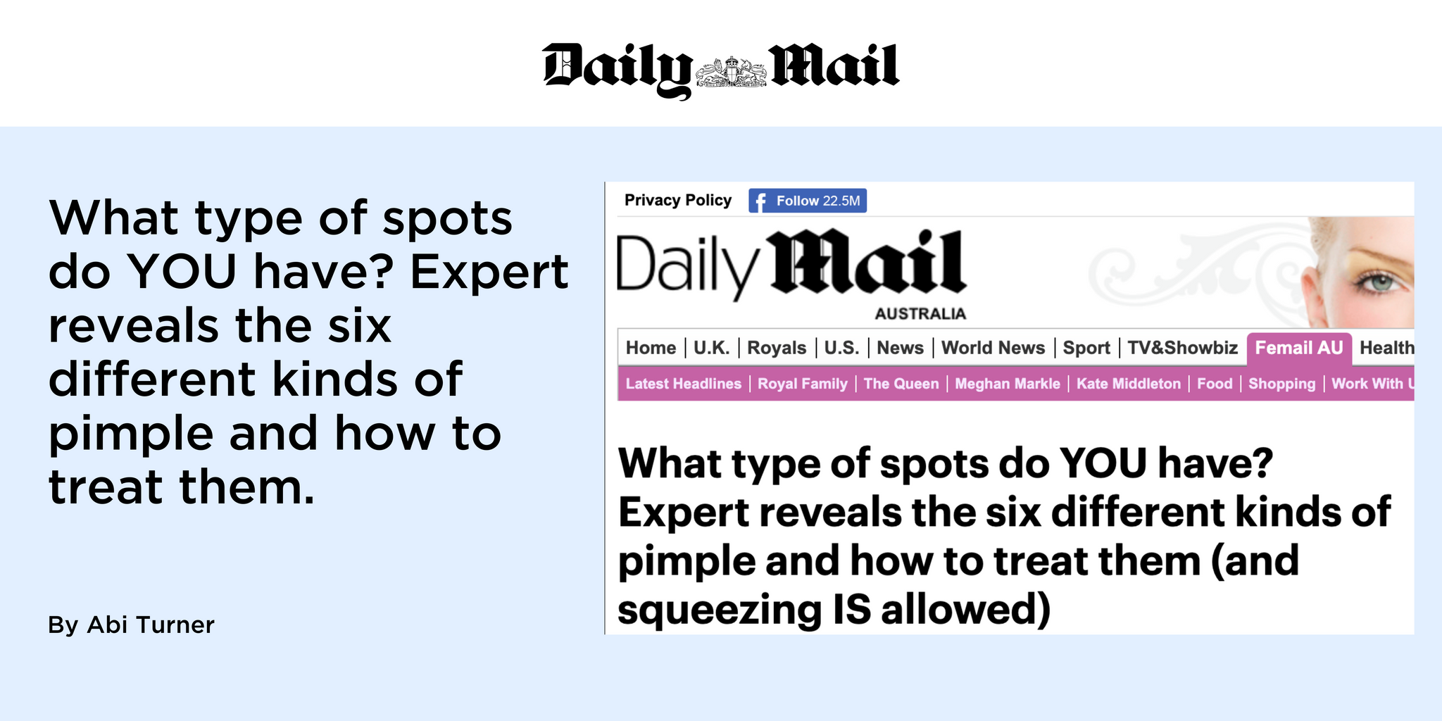 What type of spots do YOU have? Expert reveals the six different kinds of pimple and how to treat them