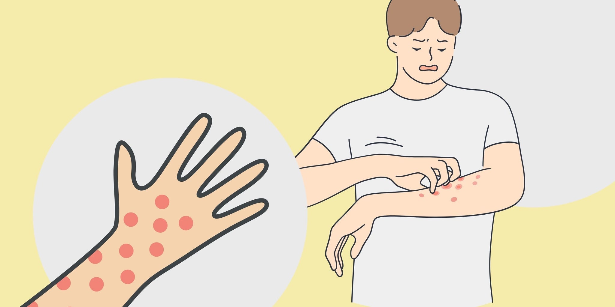 Itchy/sensitive skin - what can you do?