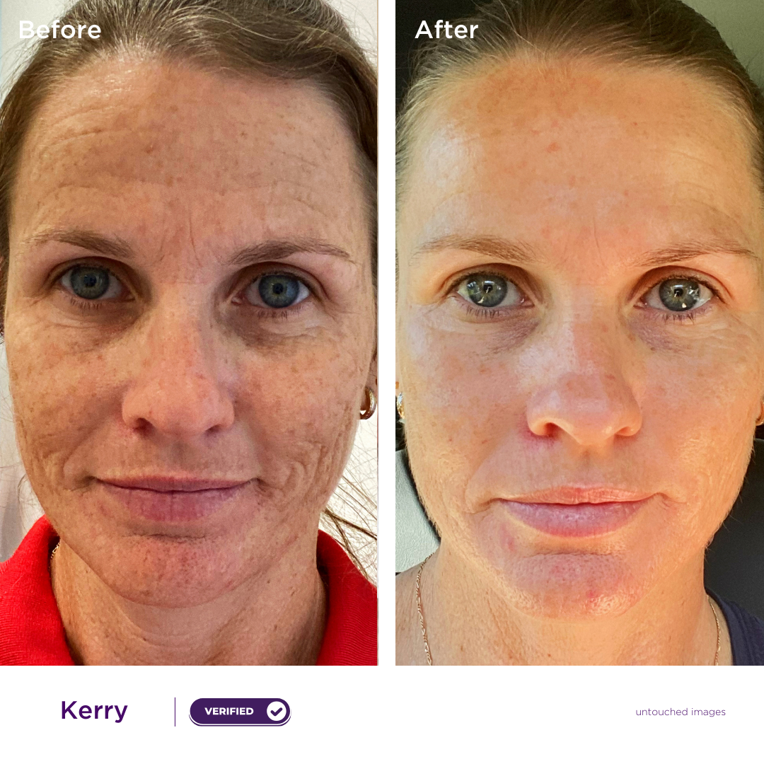 Pigmentation Hero Kit