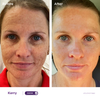 Pigmentation Hero Kit