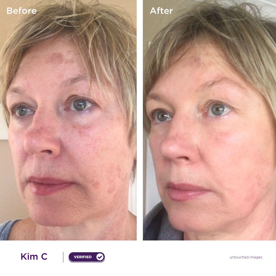 Core Anti-Aging Bundle