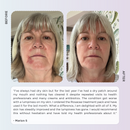Rosacea Skincare Kit - Anti Redness