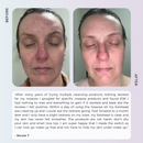 Rosacea Skincare Kit - Anti Redness