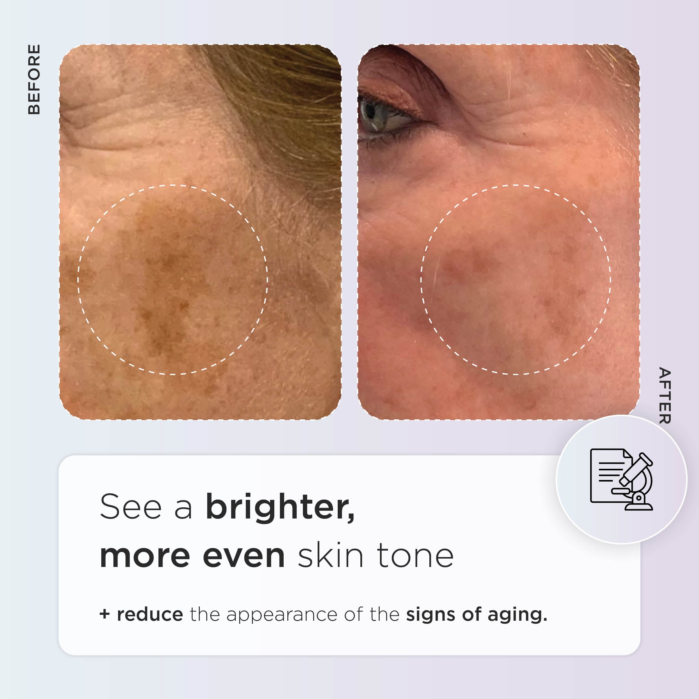 Golden Pigmentation Duo