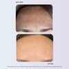 Golden Pigmentation Duo